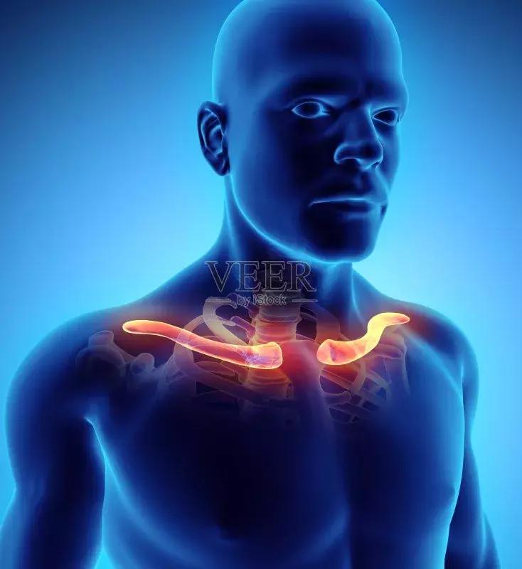 婴儿出生时锁骨骨折自然愈合,刚出生锁骨骨折睡觉姿势