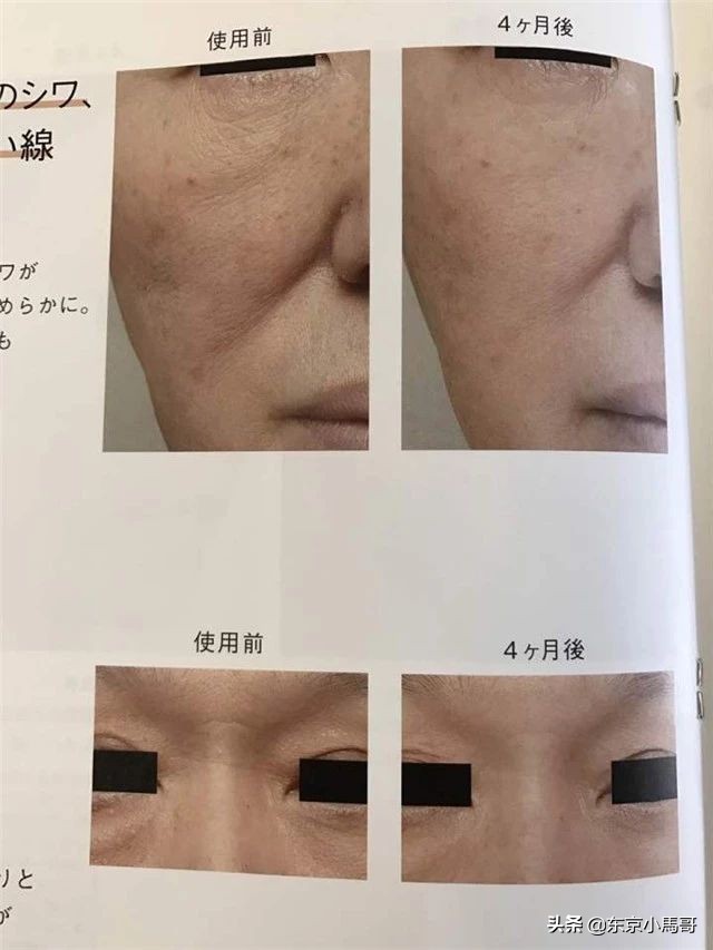 pola家的这款新升级抗皱精华 (红腰子精华和pola抗皱精华)