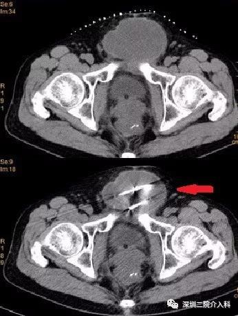 冰雕细琢流光溢彩,冰雕刺身雕刻