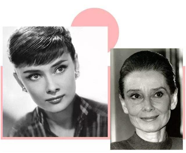 线雕和玻尿酸筋膜提升有什么区别,玻尿酸线雕是什么样子