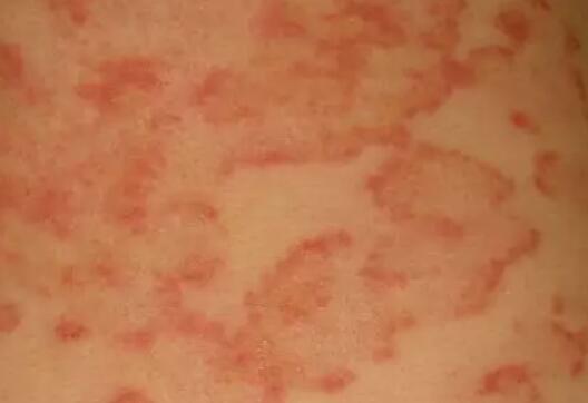 去游泳池游泳怎么预防病毒传染,游泳池防被传染小妙招