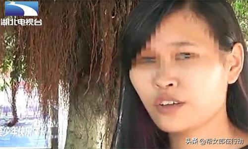 整容失败眼睛失明的案例,玻尿酸隆鼻手术失明