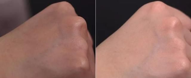 评测淡斑精华377,评测美白精华377