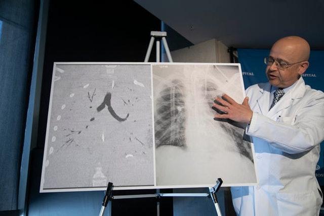 *子烟电**起源于中国,流行于欧美,商机巨大,但对人的危害超乎想象