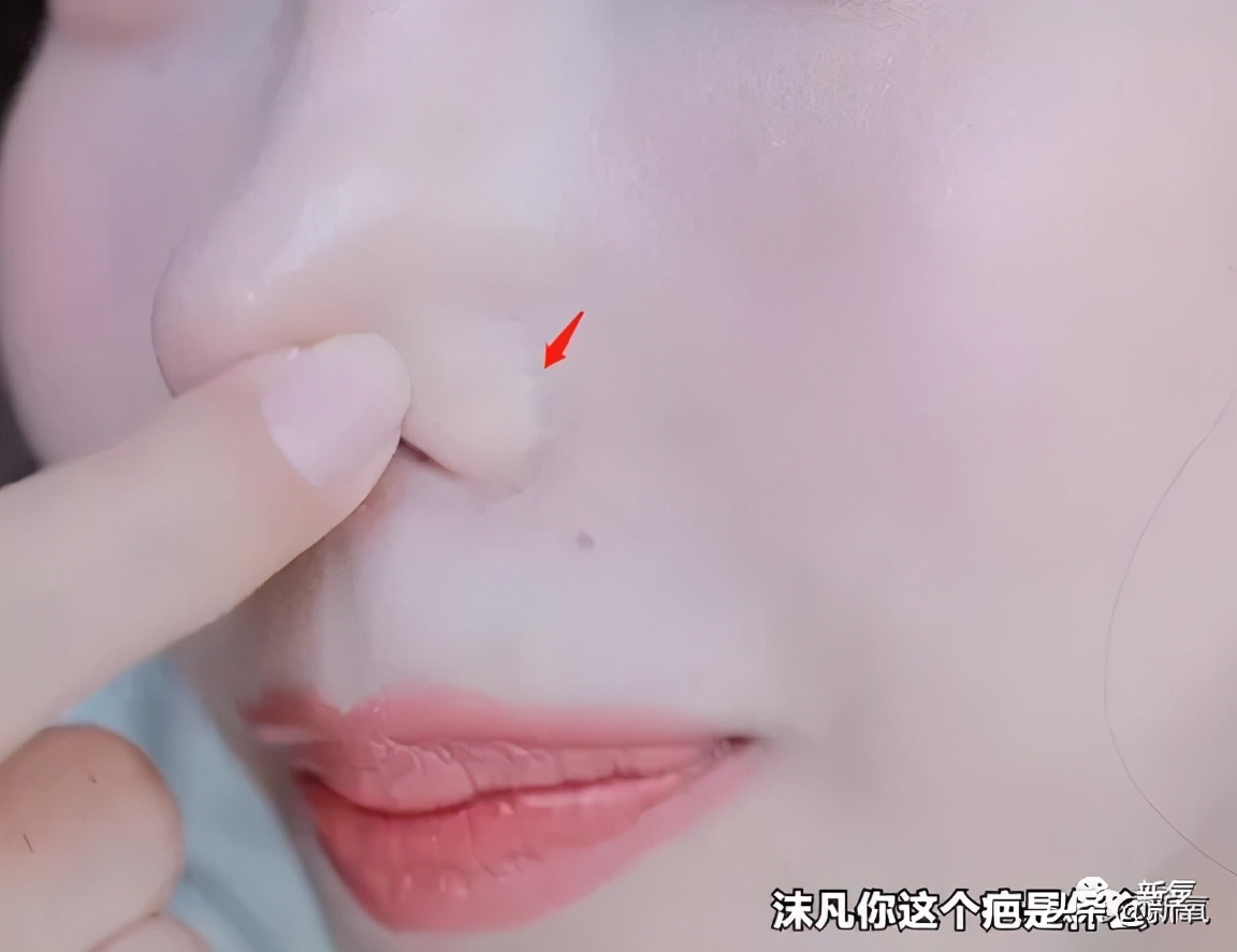 网红整鼻子整出坑,千万网红被坑