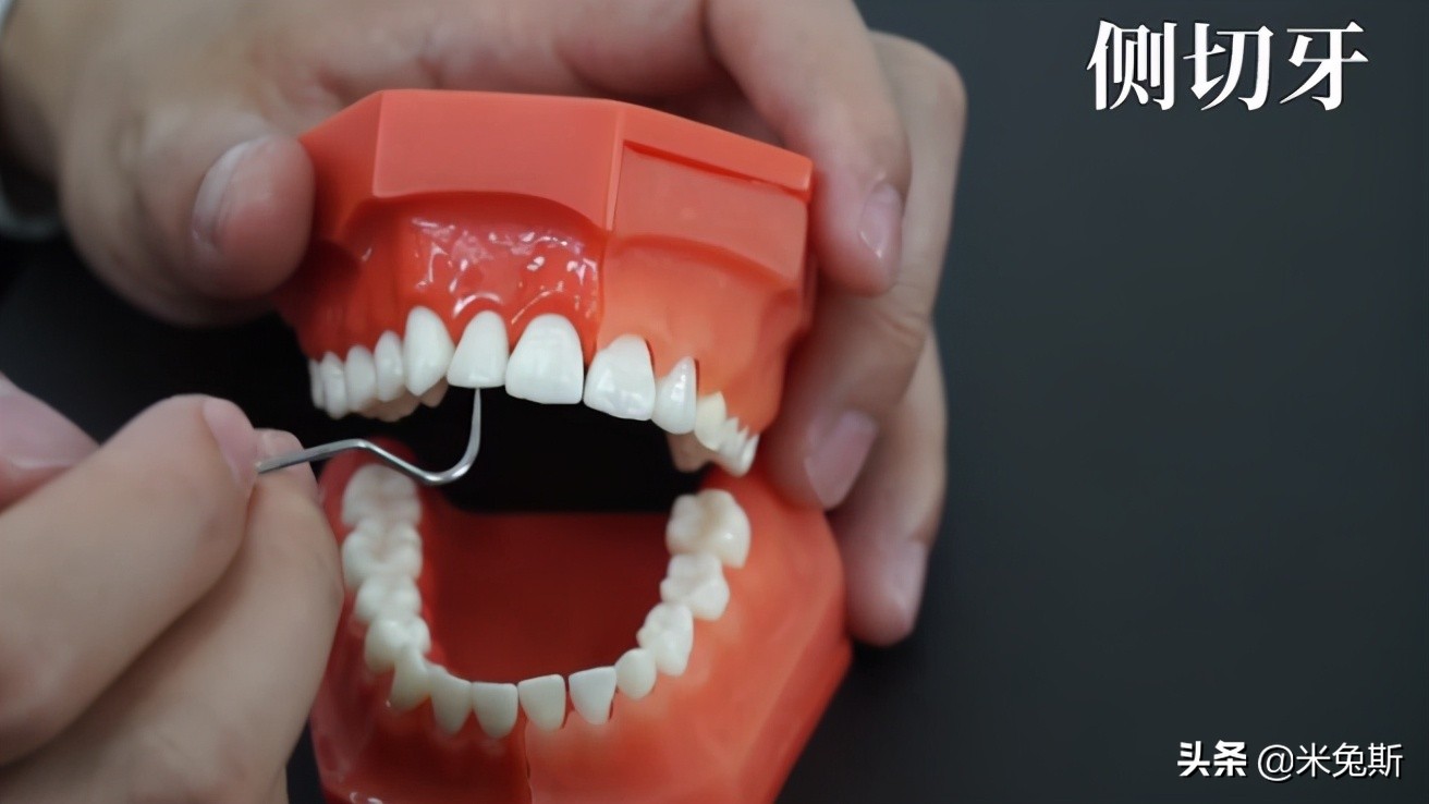 大家牙齿发育的怎么样,大家牙齿都长什么样