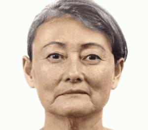 可玉医疗美容怎样,可玉医疗美容怎么样