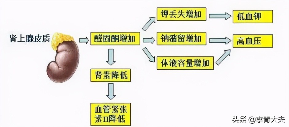 难治性高血压用什么药好,原发性高血压如今最好的治疗方式