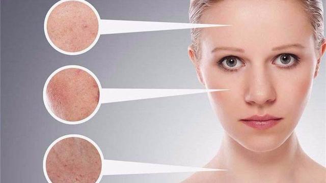 99%人不知道的6种肤质,很多人不清楚自己的肤质