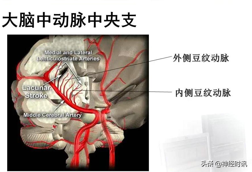 脑动脉解剖学讲解,基底节区脑血管解剖