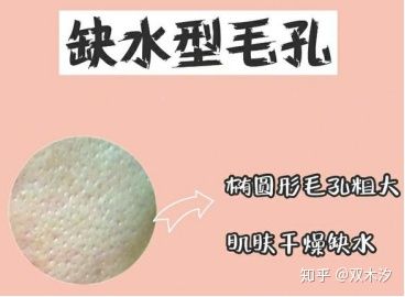 几种类型毛孔粗大改善的方法,毛孔粗大如何用科学方法改变