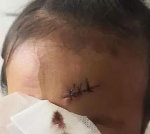 青岛第八人民医院全部科室,青岛第八人民医院皮肤科