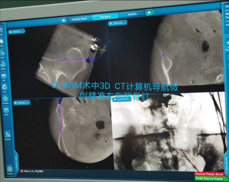 牙齿不好引发的疾病视频,牙齿有问题不做根管治疗会怎么样