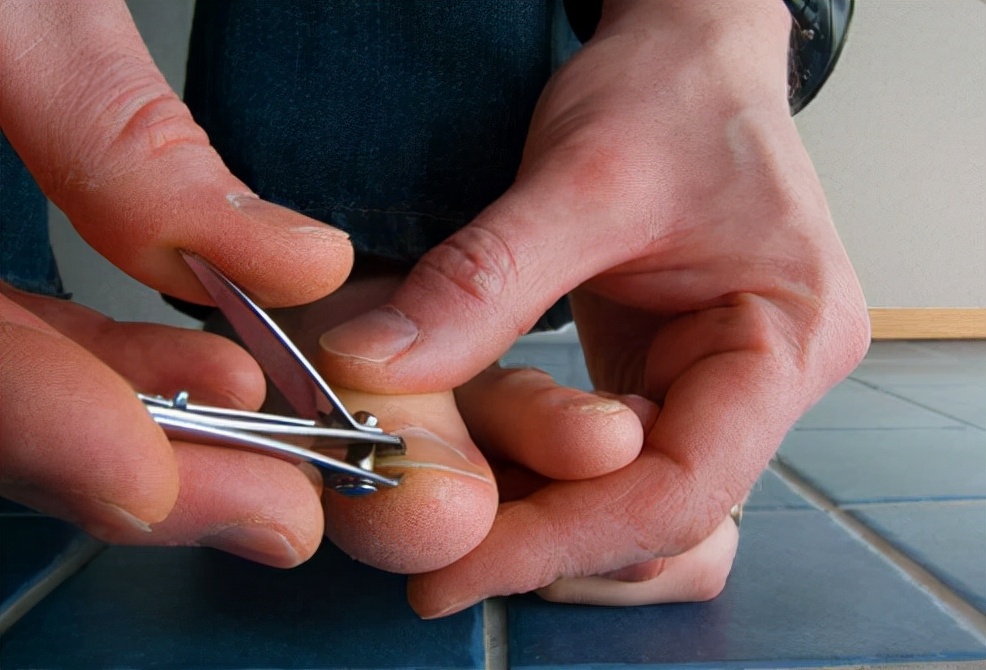 脱发与打鼾有关系吗,打呼噜和脱发的关系