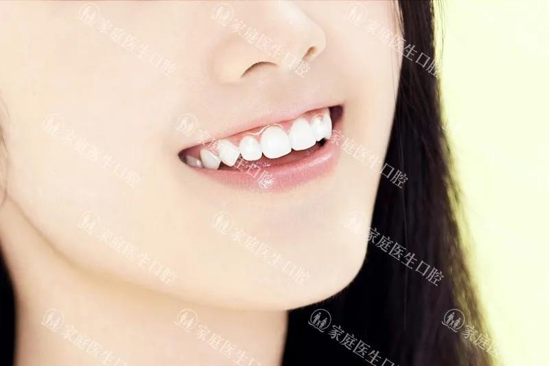 矫正牙齿的步骤及流程,矫正牙齿最快全过程