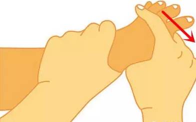 大脚趾外翻怎么锻炼恢复正常,大脚趾外翻矫正危害