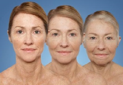 早绝经会得乳腺癌吗,早绝经老了会得老年痴呆症吗