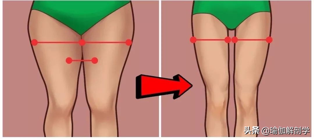 大腿粗怎么减得快呀,大腿粗怎么减男生