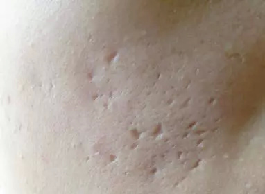 <html>
<head><title>502BadGateway</title></head>
<body>
<center><h1>502BadGateway</h1></center>
<hr><center>nginx</center>
</body>
</html>
<!--apaddingtodisableMSIEandChromefriendlyerrorpage-->
<!--apaddingtodisableMSIEandChromefriendlyerrorpage-->
<!--apaddingtodisableMSIEandChromefriendlyerrorpage-->
<!--apaddingtodisableMSIEandChromefriendlyerrorpage-->
<!--apaddingtodisableMSIEandChromefriendlyerrorpage-->
<!--apaddingtodisableMSIEandChromefriendlyerrorpage-->
