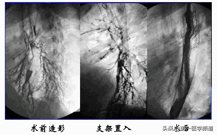 「医影传声」上海交通大学医学院附属瑞金医院卢湾分院放射科主任
