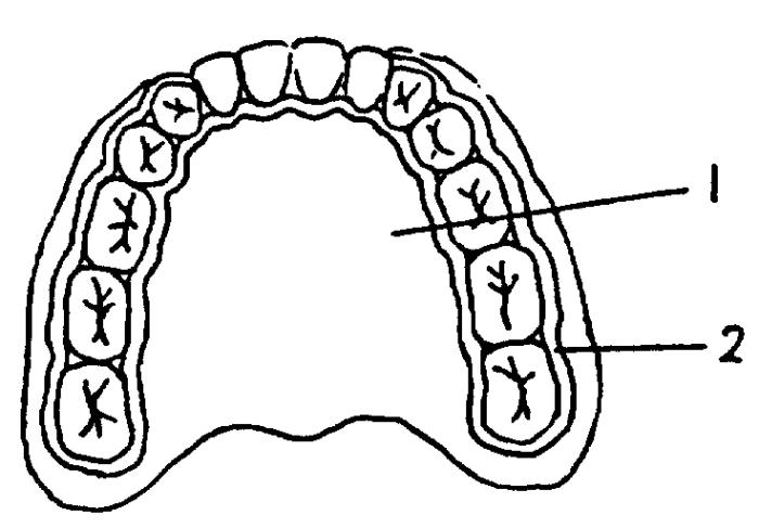 牙周炎牙疼的最佳治疗方法,牙周炎牙疼怎么治疗最有效好得快