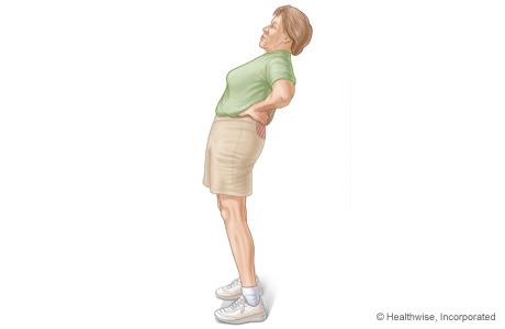 腰椎管狭窄一般是怎么引起的,腰椎管狭窄是什么症状怎么治疗