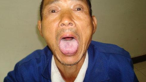 为啥有些人嘴唇比较紫正常,有的人嘴唇发紫是什么原因