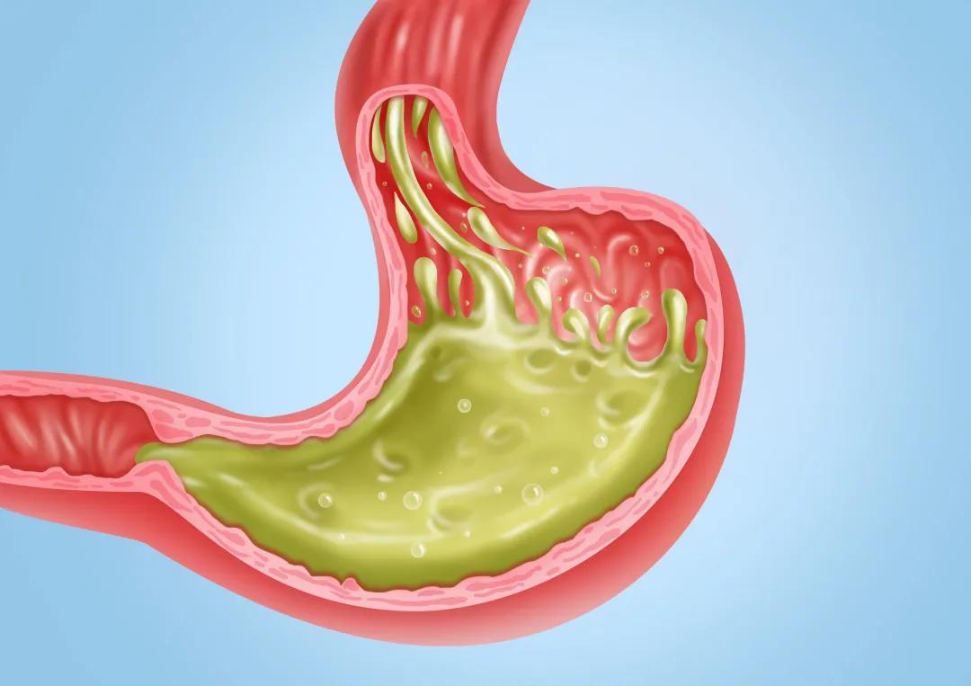 得胃病一吃东西就不舒服怎么办,中医胃病吃什么食物养胃