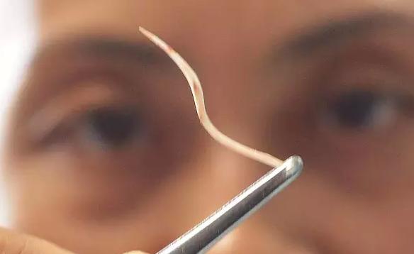 鱼刺卡喉咙威灵仙可以去除鱼刺吗,鱼刺卡住喉咙的偏方