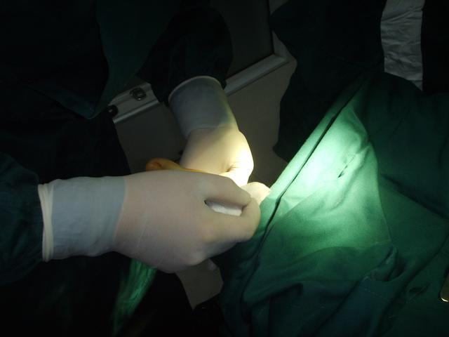 脚大可以做小吗？脚宽能做窄吗？想要把脚做小巧一些