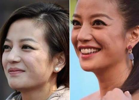 去细纹的电动眼霜,能熨平皱纹的眼霜