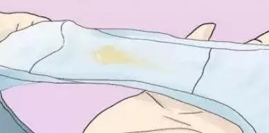 白带异常有异味,白带异常有血丝