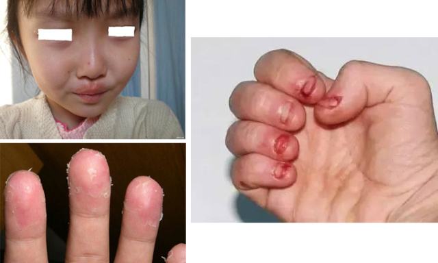 孩子吮吸手指的危害,吮吸手指行为的表现