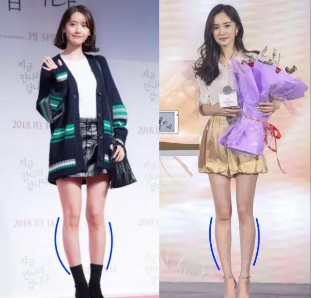 腿不直小腿外翻可以矫正过来吗,腿不直小腿外翻其实坐着就能解决