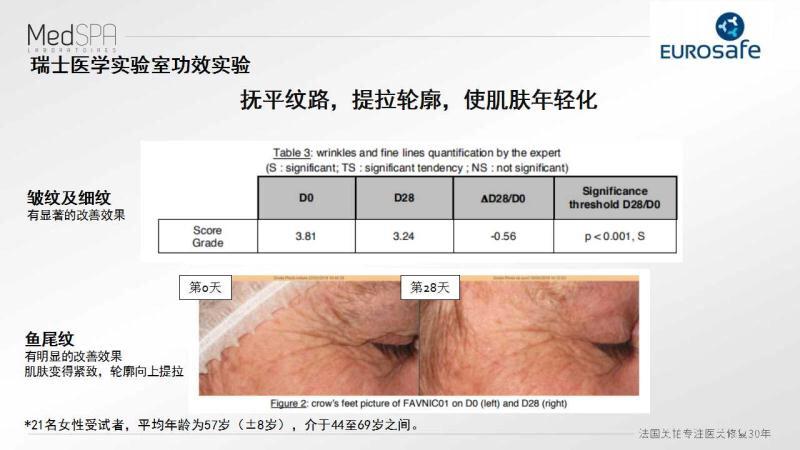 美帕肉毒精华,美帕涂抹型肉毒素怎么用