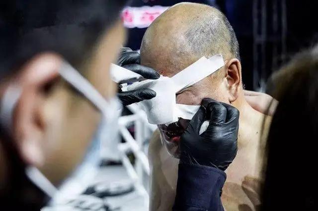 田野又有新动作？自曝3月底赴昆明拍戏，7月份有比赛打非洲选手