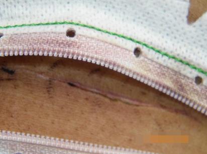 剖腹产28天突然伤口流脓,剖腹产后不到2个月伤口突然崩裂