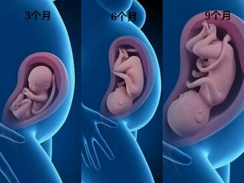 顺产转剖宫产,顺产转剖腹产后遗症
