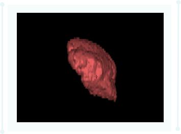 ct后处理重建技术,ct后处理技巧