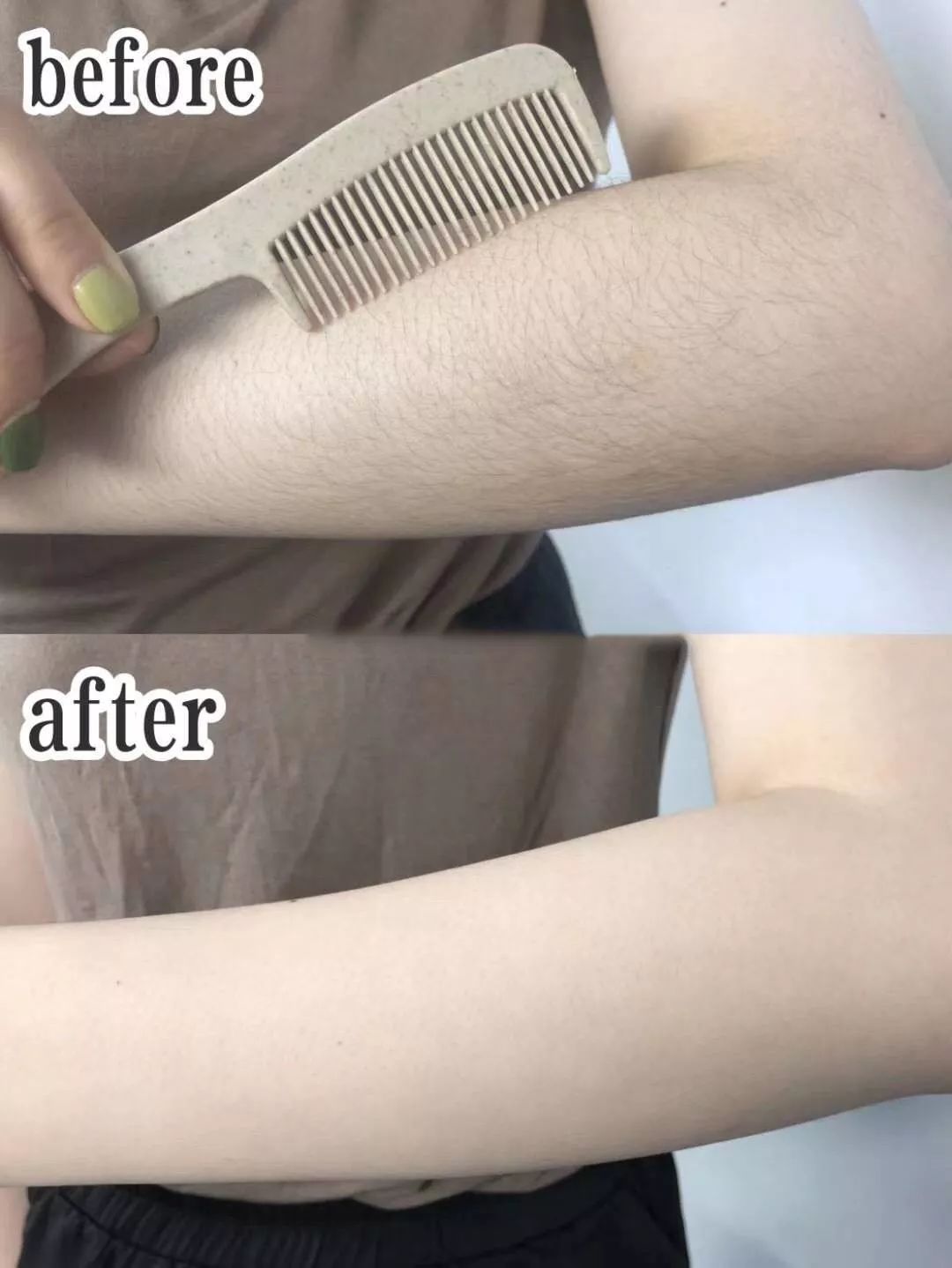 如何脱毛永远不会再长小技巧,怎么摆脱脱毛的尴尬