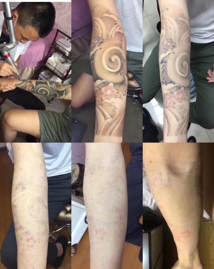 分手了情侣纹身怎么弄,分手了纹身怎么处理