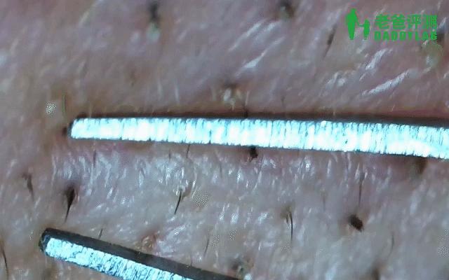 如何用简单的方法去黑头真实有效,别挤了教你去黑头的正确方法