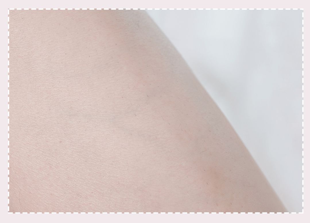 体毛脱毛的效果怎么样,天生体毛旺盛的人正常吗