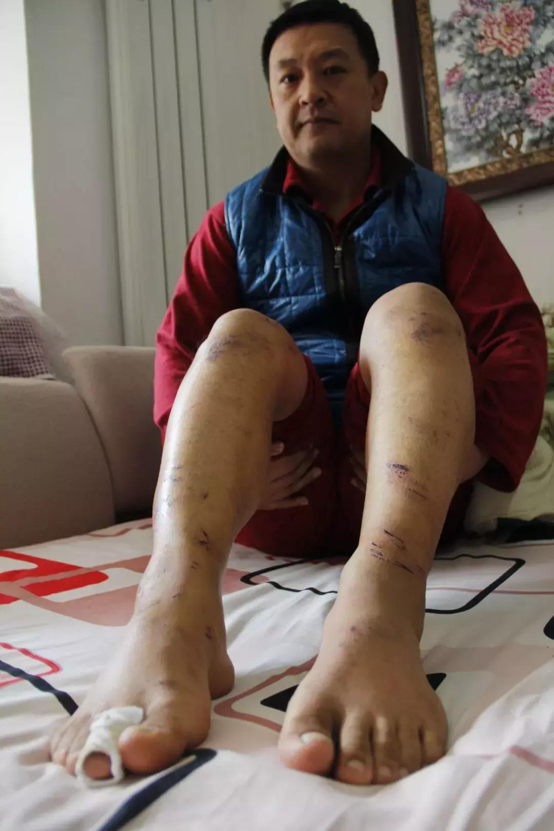 旱鸭子跳入冰窟,谁是城市英雄完整版