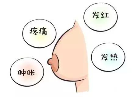哺乳期妈妈外出怎么解决涨奶,哺乳期涨奶怎么办快速解决