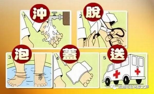 贵阳凹陷烫伤疤痕怎么修复,烧烫伤疤痕增生凸起怎么治