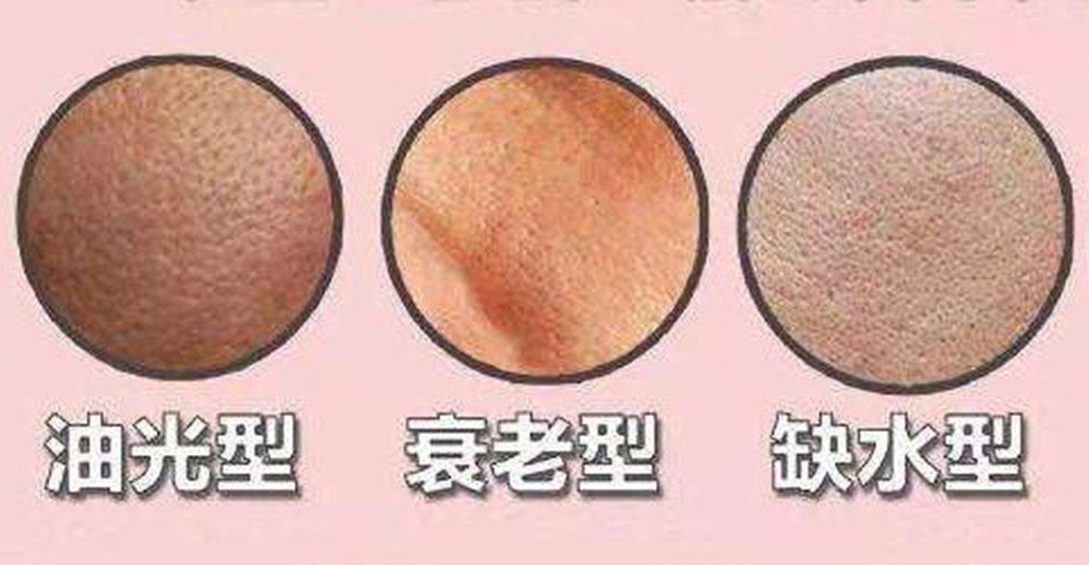 背部毛孔粗大像个马蜂窝,毛孔粗大修复日常