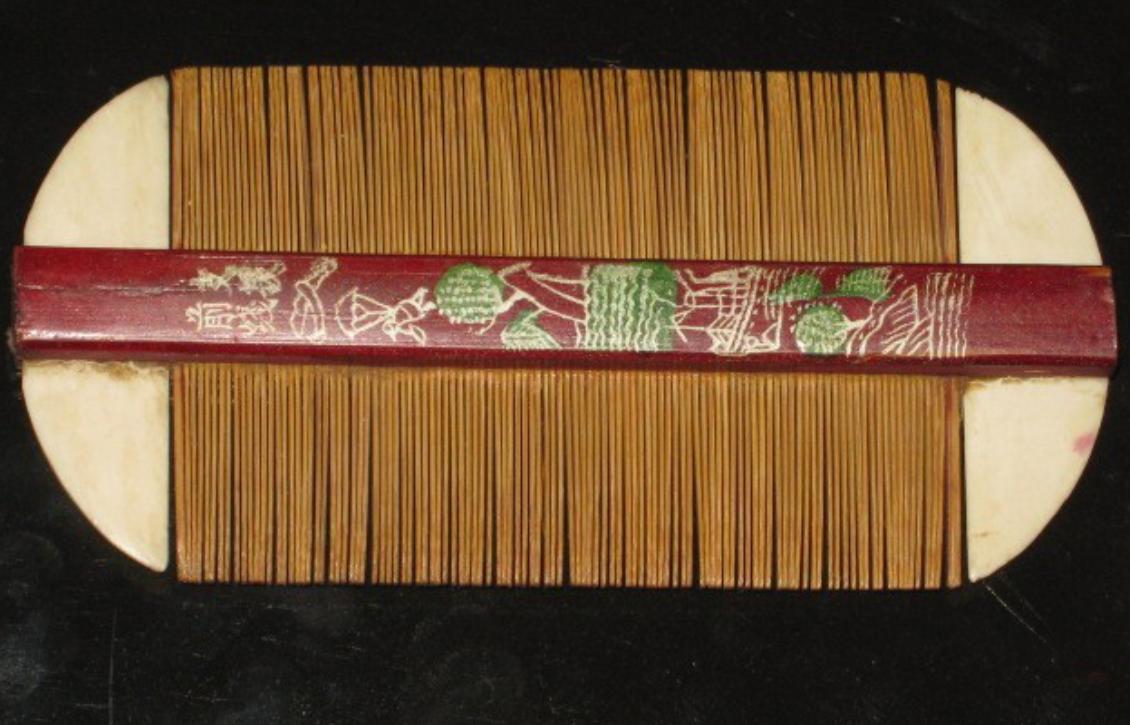 30年前每个人身上都有虱子,30年前人人都有的虱子为什么不见