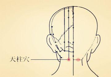 风寒湿型颈椎病针刺穴位,颈椎病风寒湿痹经络受阻