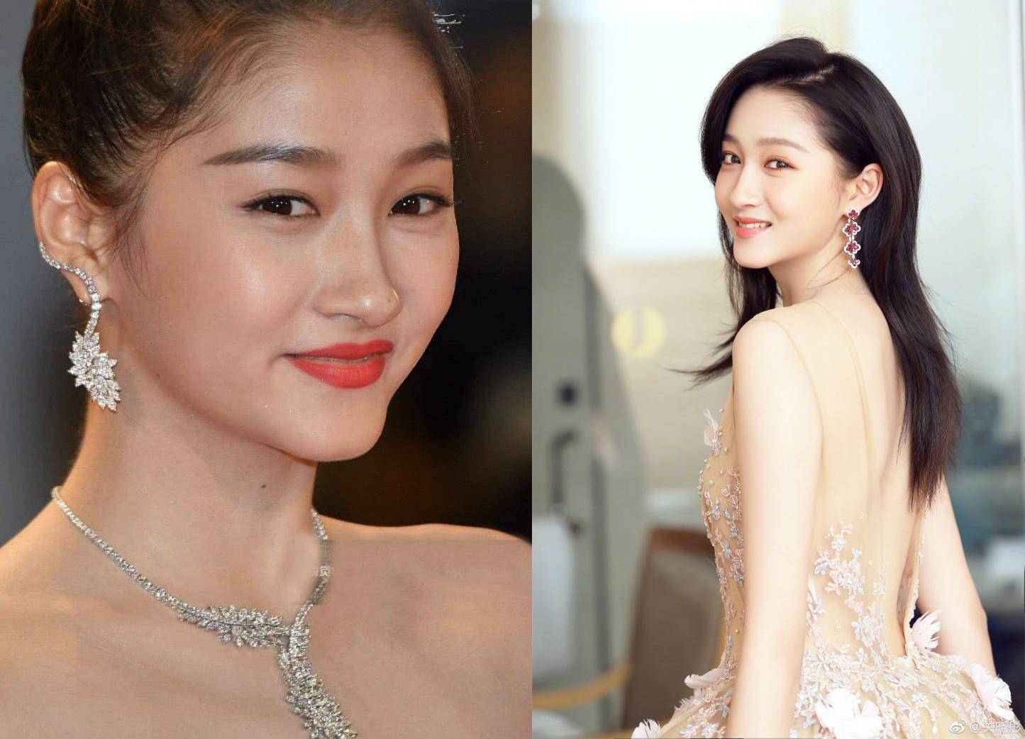 艾芙芷指南：天生皮肤黑的人，可以后天变白吗？